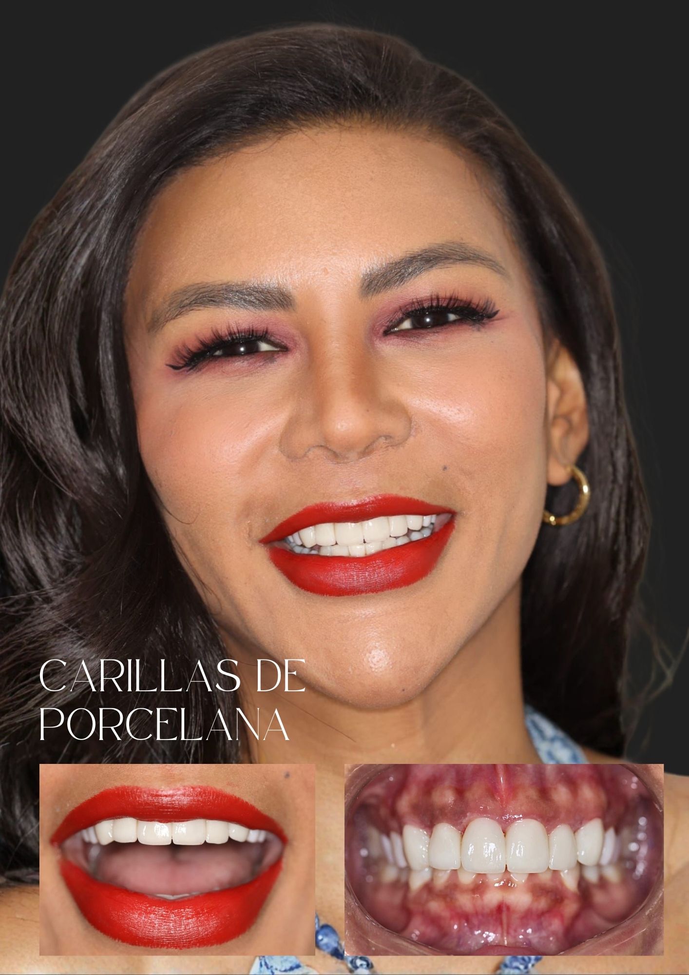 Odontología Estética